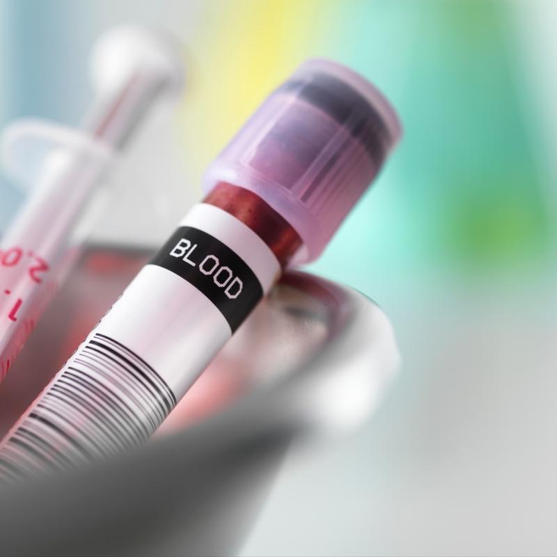 Bu kan grubundaysan�z diyabet �anlar� �alabilir! Bilim insanlar� a��klad�