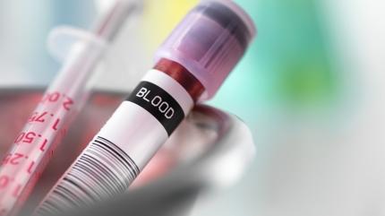 Bu kan grubundaysan�z diyabet �anlar� �alabilir! Bilim insanlar� a��klad�