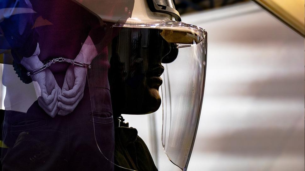 Ameliyatla kardeşinin yüzünü aldı! Ankara'da film gibi operasyon