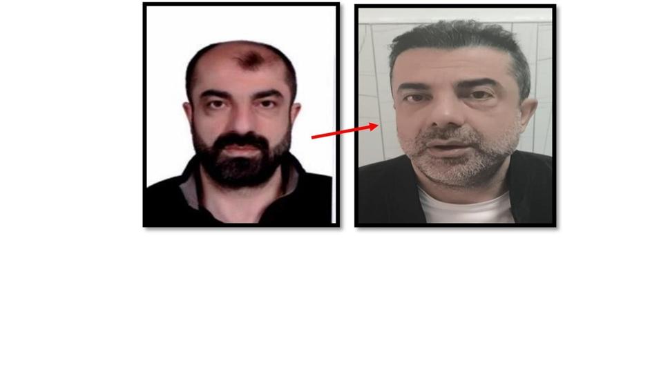 Ameliyatla kardeşinin yüzünü aldı! Türkiye'ye sızınca yakayı ele verdi