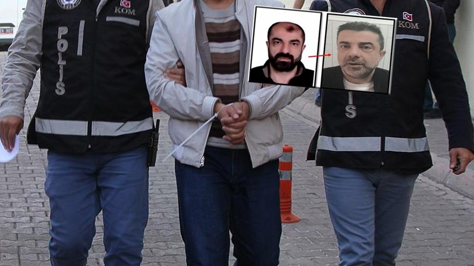 Estetik oyunu fayda etmedi! Cinayet zanlısı ülkeye girince paketlendi