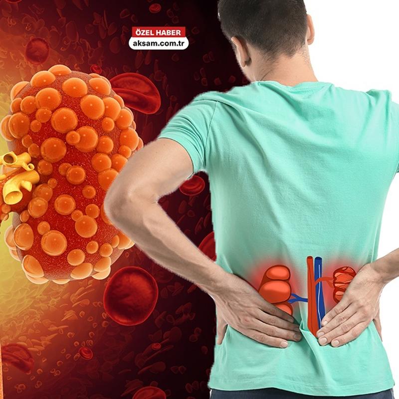 Kronik b�brek hastal��� risk gruplar�nda kimler var? Nefroloji Uzman� testleri a��klad�