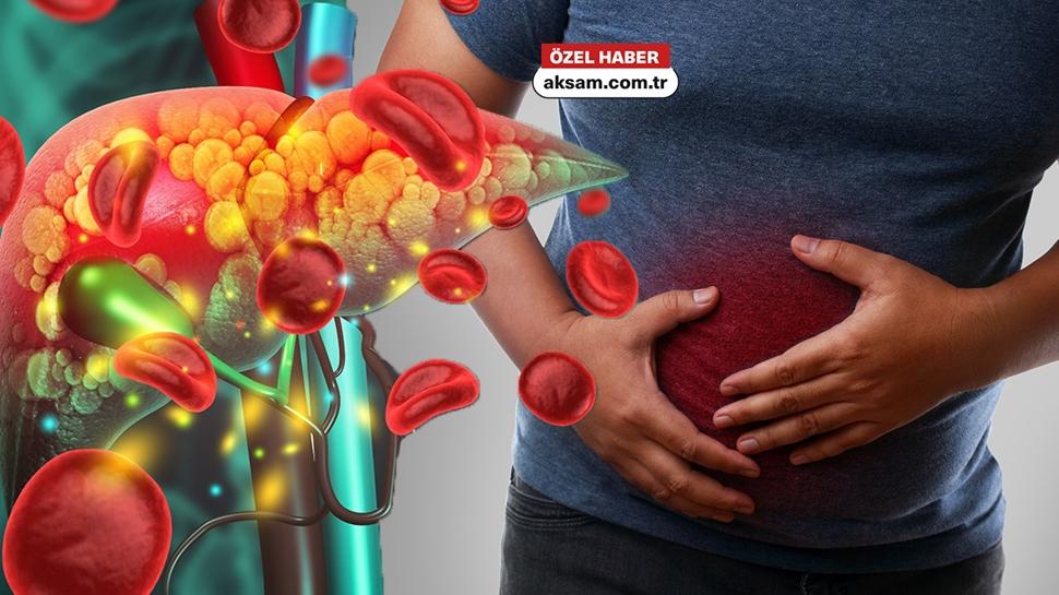 2050'ye kadar 2 milyar ki�i karaci�er hastas� olabilir! Organ Nakli Uzman� uyard�: Gizli belirtilere dikkat!