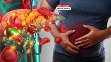 2050'ye kadar 2 milyar ki�i karaci�er hastas� olabilir! Organ Nakli Uzman� uyard�: Gizli belirtilere dikkat!