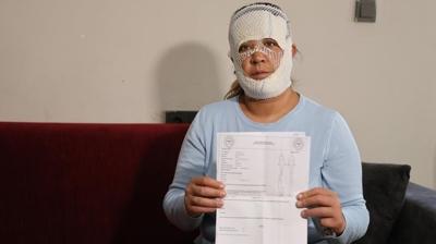 G�zelle�mek u�runa gitti, y�z� yand�: O�lum beni g�r�nce 