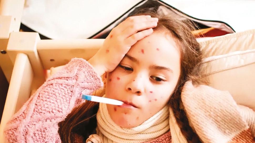 İstanbul'da kızamığa karşı 