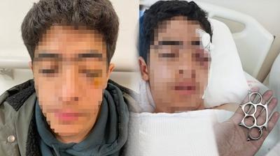 Akran zorbal��� s�n�rlar� a�t�: 15 ya��ndaki gen� mu�tayla darbedildi