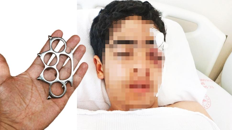 Akrandan muştalı saldırı! Kulağından çene yapıldı gözünü kaybedebilir