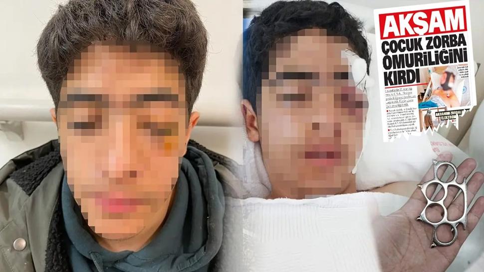 AKŞAM, manşete taşımıştı! Yine muşta, yine akran zorbalığı