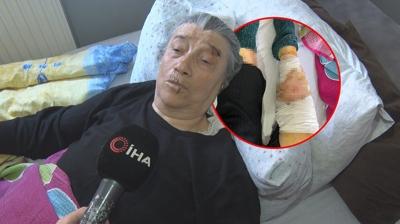 Ankara'da ba��bo� k�pek deh�eti! Ya�l� kad�n �l�mden d�nd� 