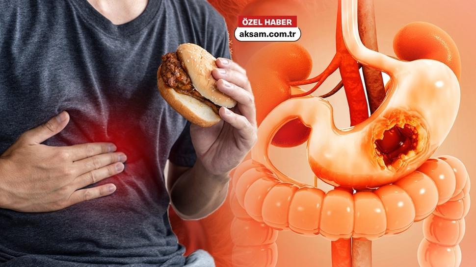 Gastrit tedavisinde ezber bozan açıklama: Kesin yasak diye bir şey yok!Mide için 5 kurala dikkat!