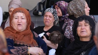 Estetik hayali facia ile bitti! 'Ayaklar�yla gitti, cenazesi geldi'