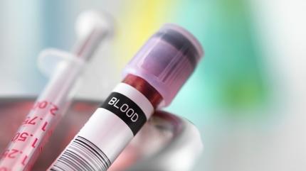 Enfeksiyon onlara u�ram�yor: En sa�l�kl� kan grubu