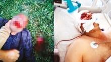 Baba-o�ul komal�k etti! K�pek kavgas�na �fkelendiler
