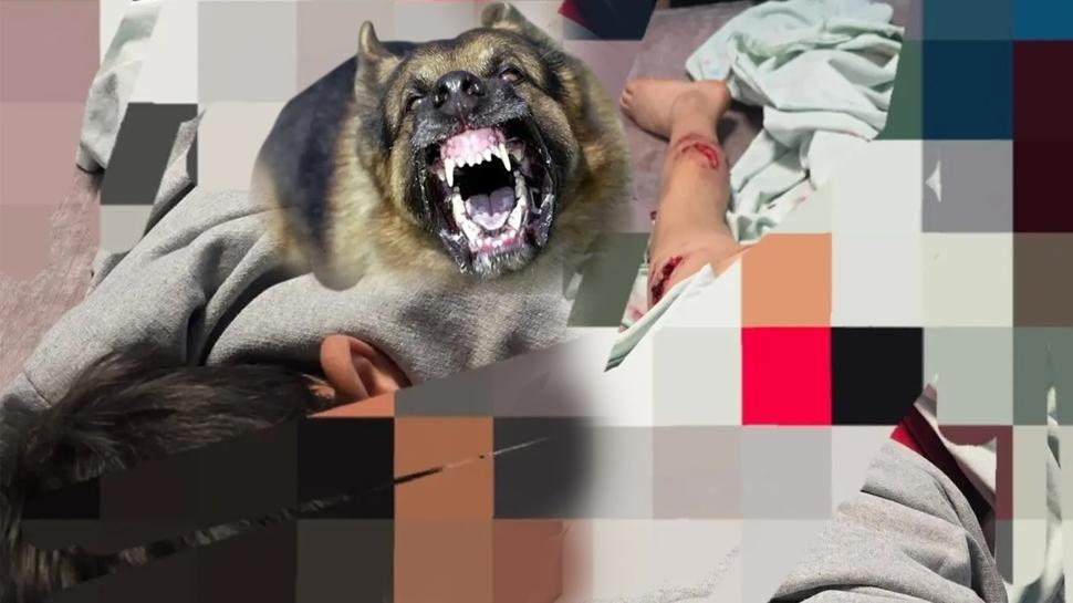Sahipsiz köpek terörü sürüyor! 11 yaşındaki çocuk ölümden döndü