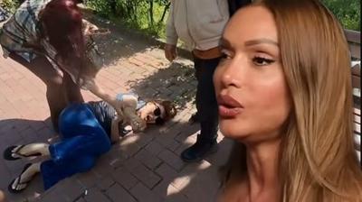 Sevda Demirel parkta y�r�rken d��t�, aya�� k�r�ld�! Ac� i�inde k�vrand�...