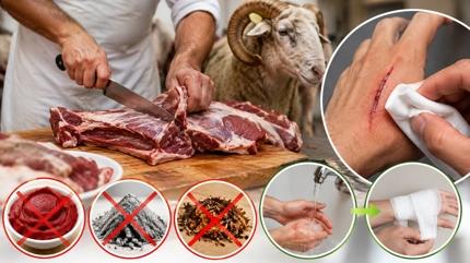 Uzman�ndan acemi kasaplara Kurban Bayram� uyar�s�: K���k kesilerde yaraya asla sal�a s�rmeyin