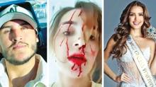 Krali�enin y�z�n� makasla par�alad�... Cannes'da skandal sald�r�
