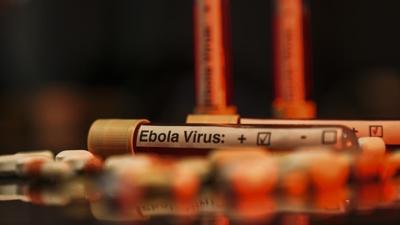 İtalya'dan AB'ye Ebola'ya karşı koordinasyon çağrısı