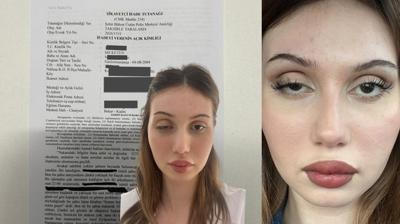 D���n�ne 3 ay kala botoks kurban� oldu! Sahte doktor skandal�