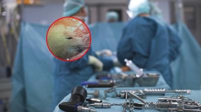 Doktorlar bile g�zlerine inanamad�! Akl�m�za gelmeyen ba��m�za geldi