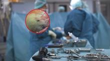 Doktorlar bile g�zlerine inanamad�! Akl�m�za gelmeyen ba��m�za geldi