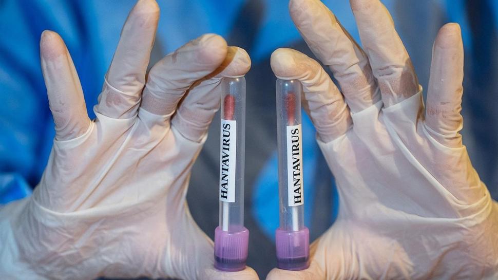 DSÖ'den hantavirüs açıklaması: Durum istikrarını koruyor