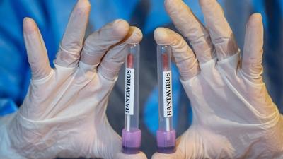 DS�'den hantavir�s a��klamas�: Durum istikrar�n� koruyor