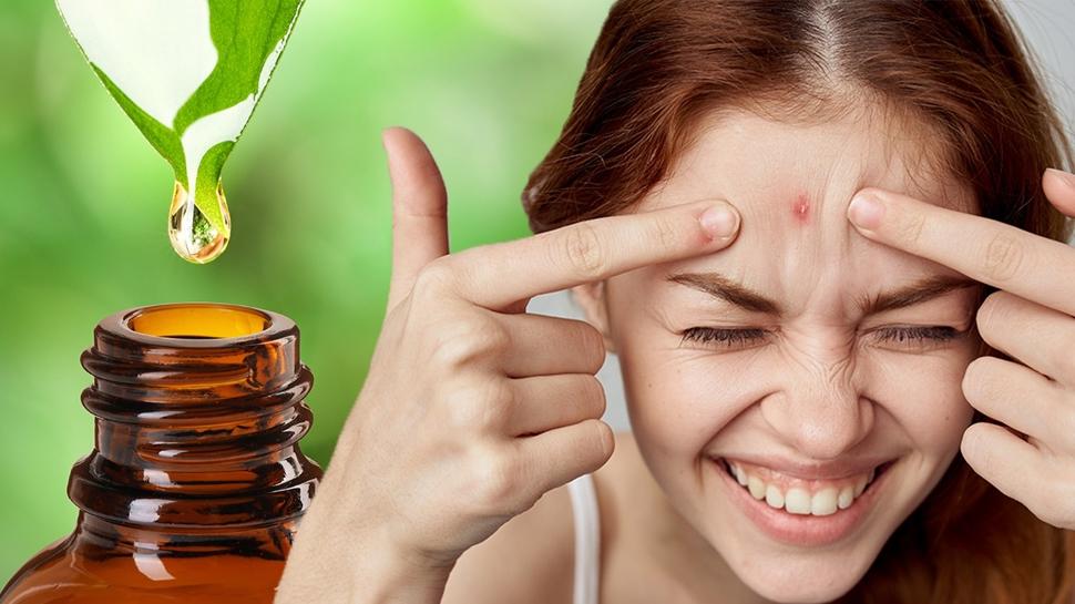 Sivilceyi s�kmak b�y�k hata! Gece �zerine sadece 1 damla s�r�n, sabaha kurutulmu� olarak uyan�n