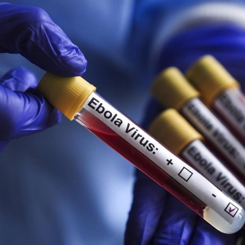 BM'den Ebola uyar�s�: 1 milyon ki�i daha yoksullu�a s�r�klenebilir