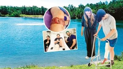 Et yiyen bakteri k�busu! G�le atlad� baca��n� kaybedecekti