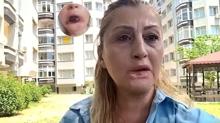 Antalya'da estetik facias�: Hayat�m� hi�e sayd�lar
