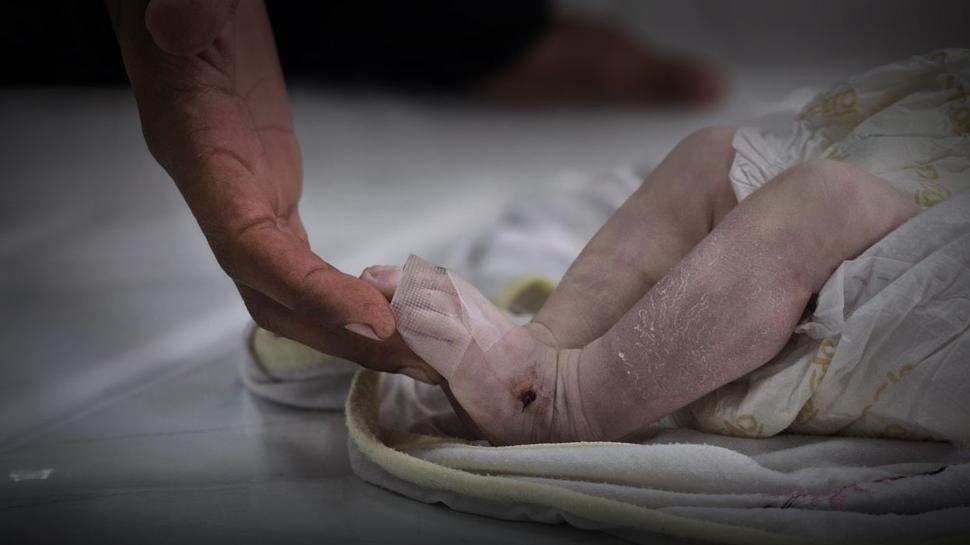 Fransa'da nüfus eriyor: Perinatal bebek ölümleri hızla artıyor