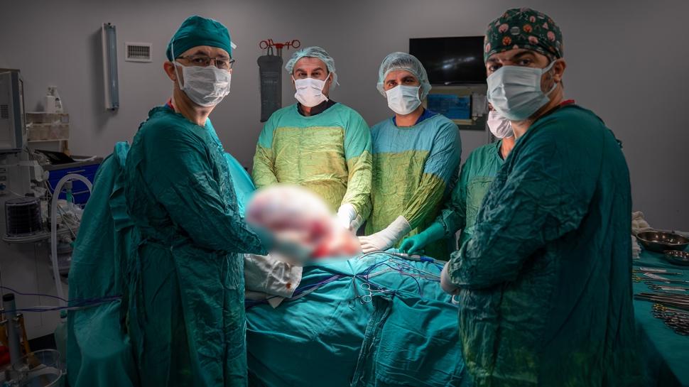 Karın ağrısı ve şişkinlikle hastaneye gitti! Karnından 15 kiloluk kitle çıktı