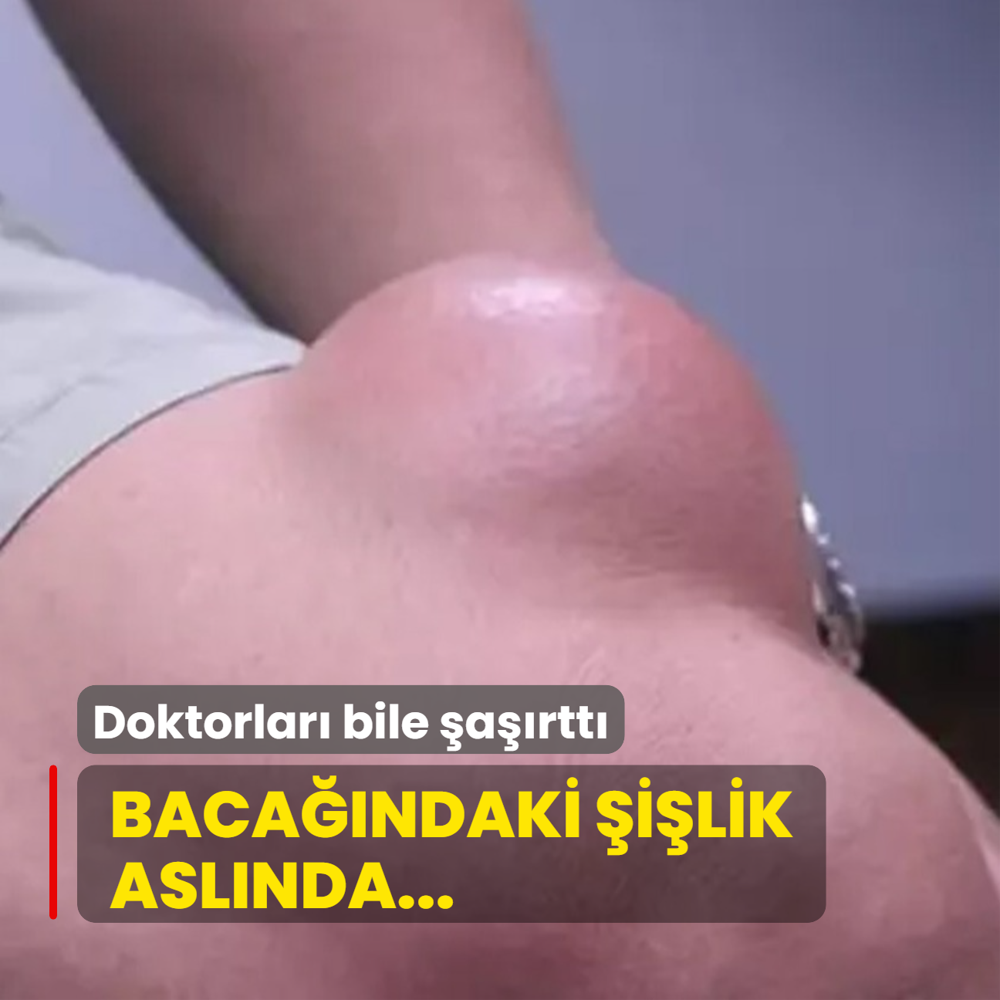inden kanlar doktoru bile artt! Bacandaki ilik aslnda...