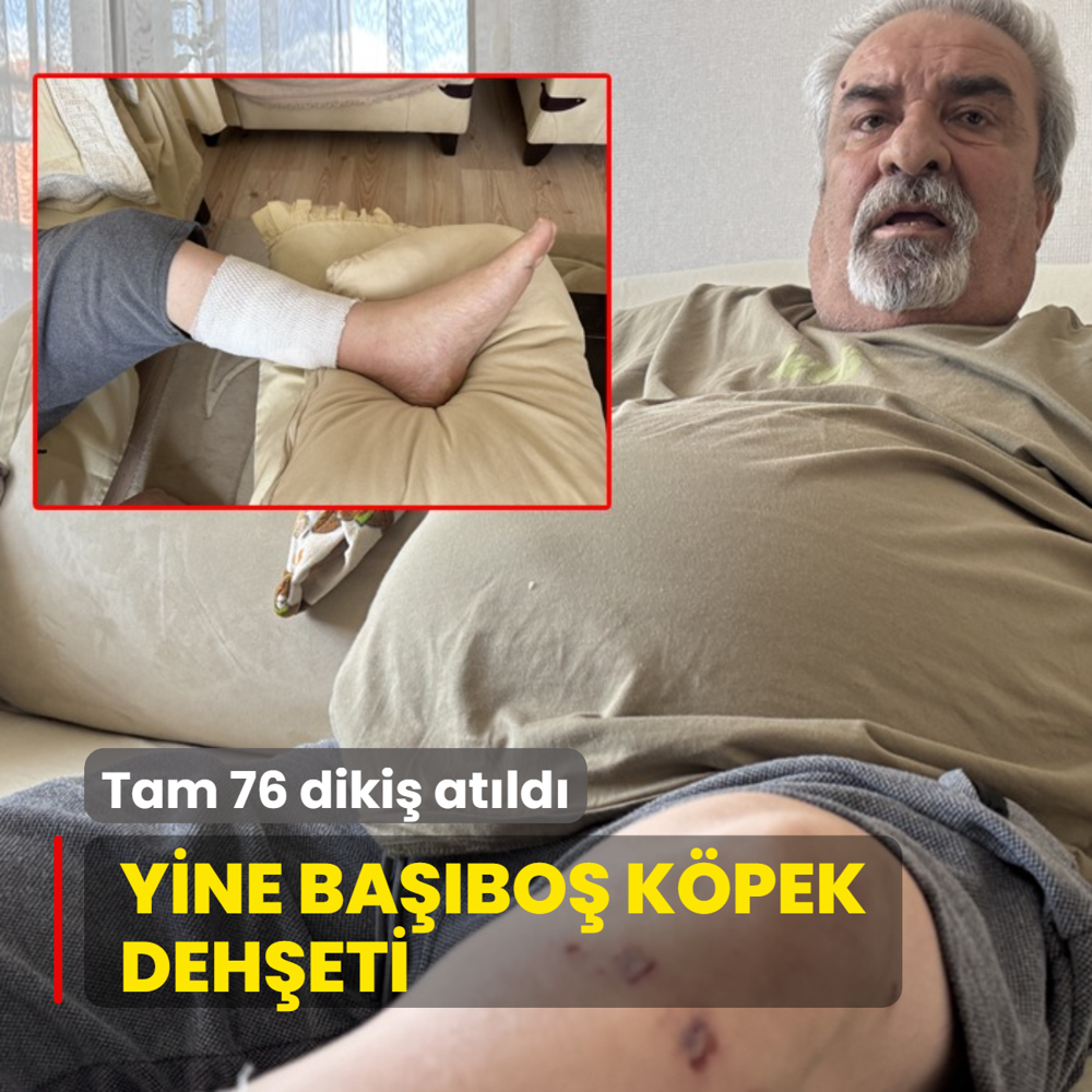 Yine babo kpek deheti: Tam 76 diki atld