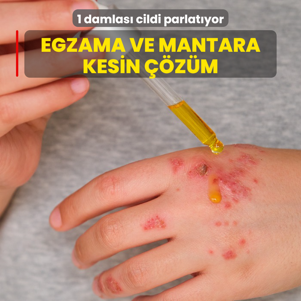 Egzamaya kesin zm: Mantarn kkn kurutuyor... 1 damlas cildi parl parl parlatyor