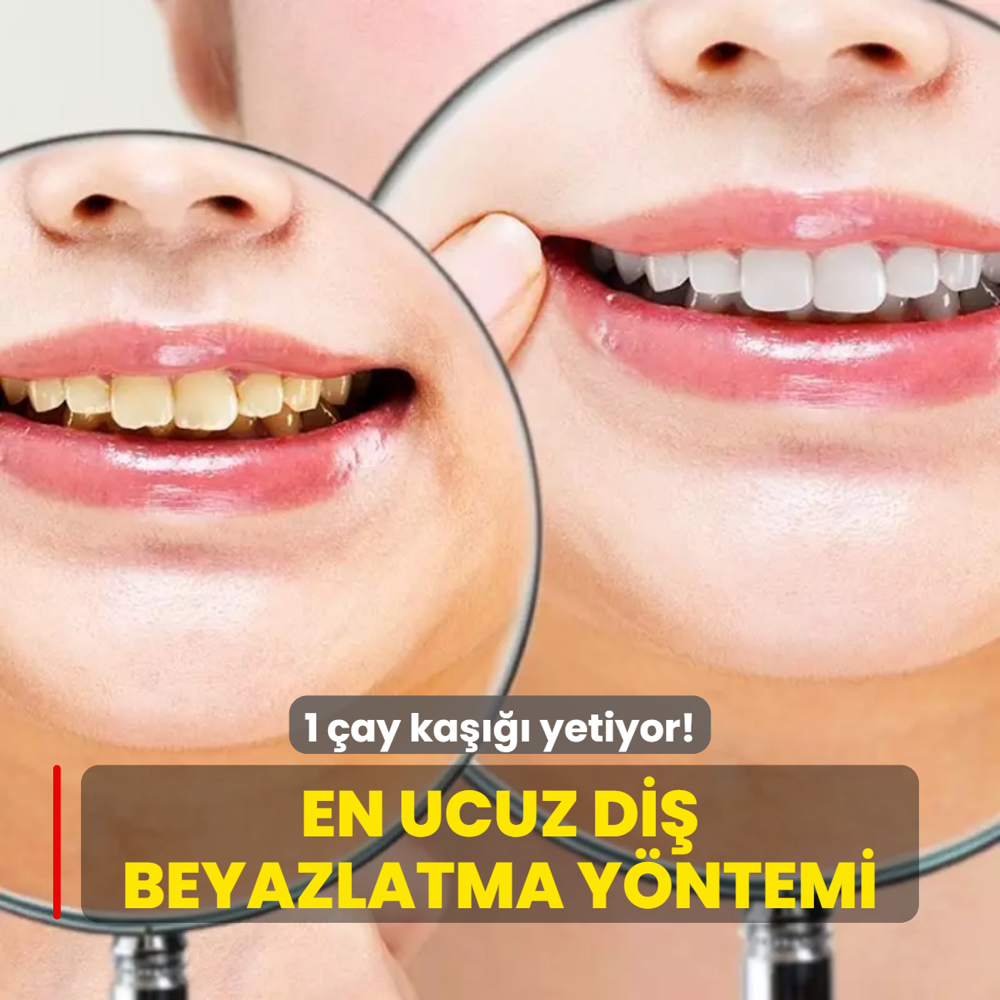 Dileri beyazlatmak 100 TL! te en ucuz di beyazlatma yntemi