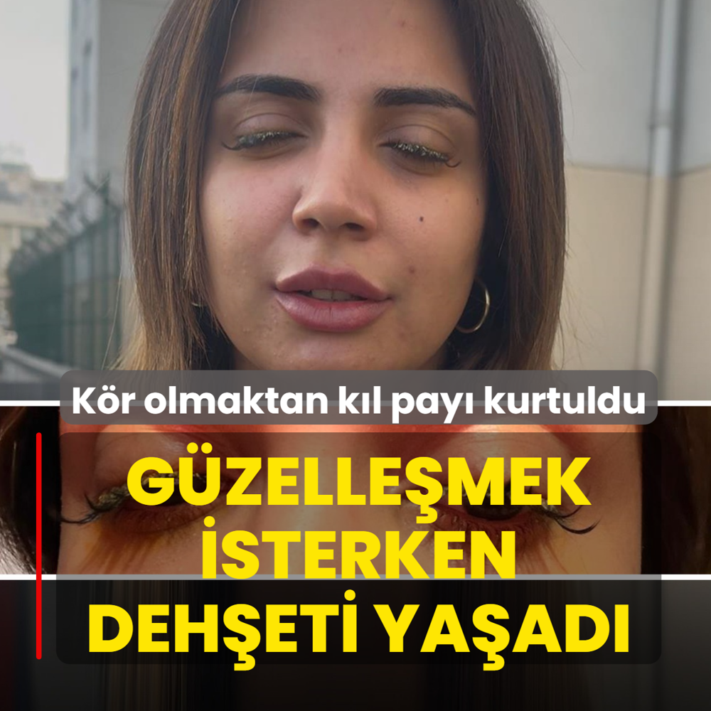 Gzellemek isterken deheti yaad! Kr olmaktan kl pay kurtuldu