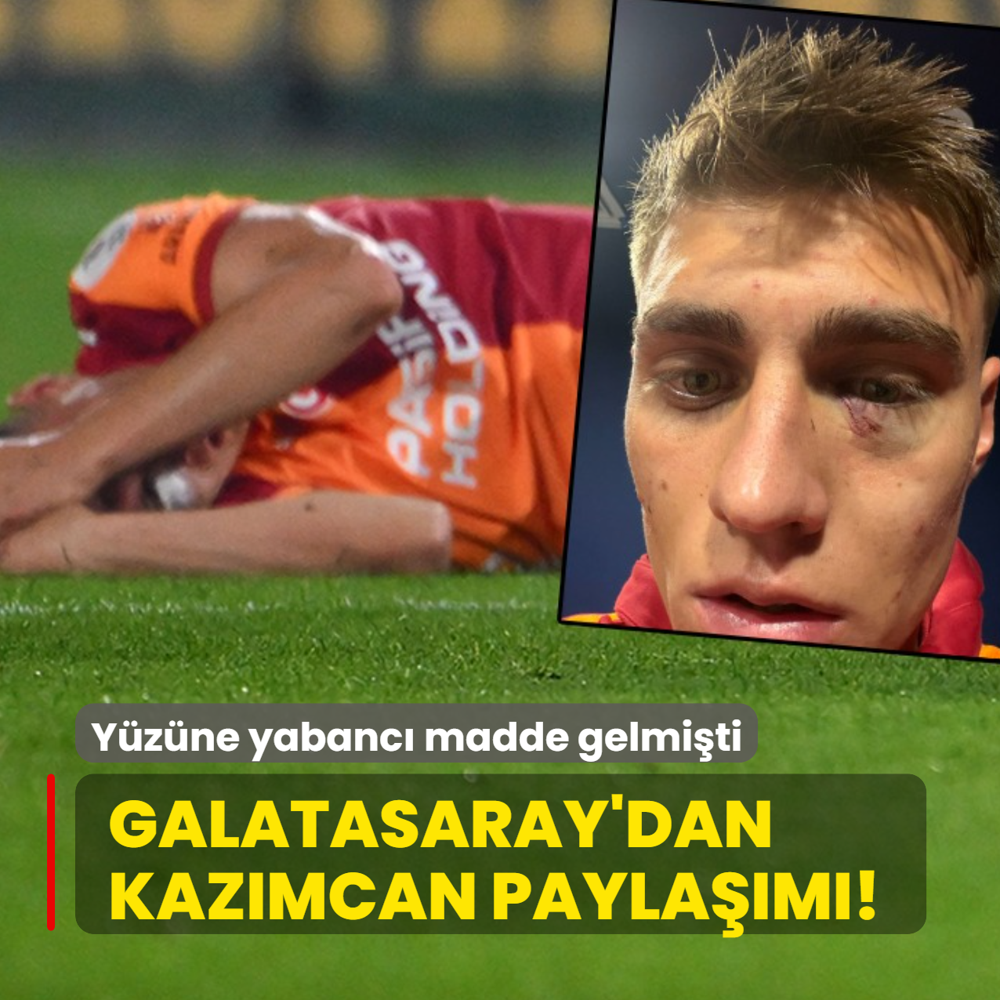Galatasaray'dan Kazmcan Karata paylam! Yzne yabanc madde gelmiti