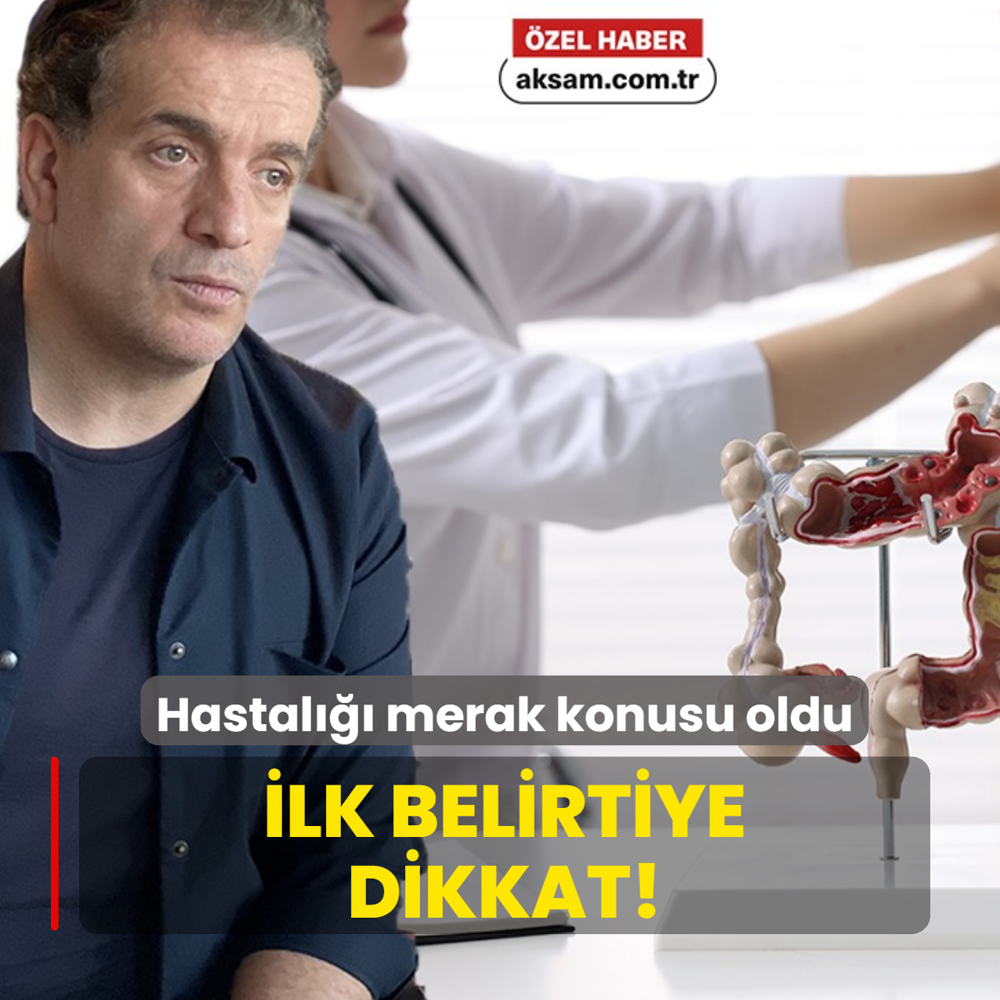 Murat Cemcir'in acil durumu hatrlatt: Divertikl kanamas nedir, belirtileri neler?