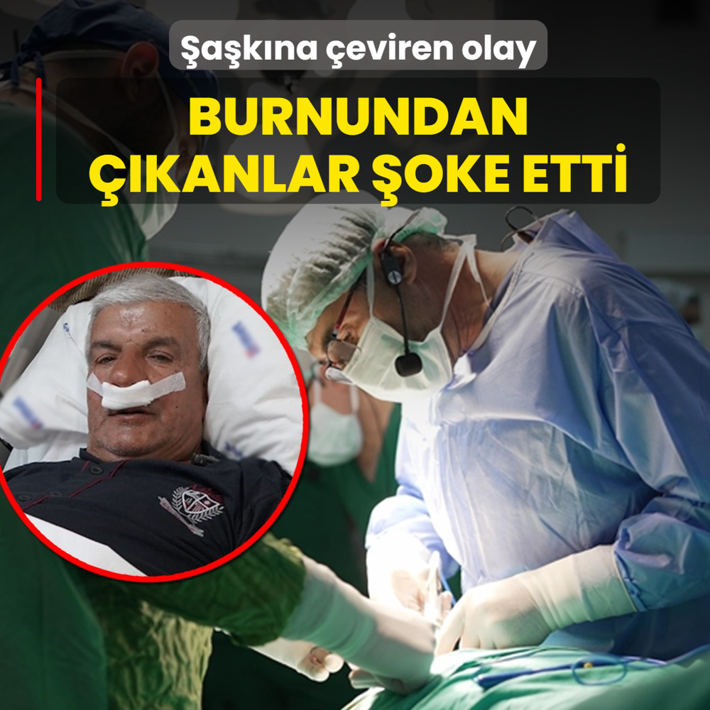 akna eviren olay! Burnundan kanlar oke etti