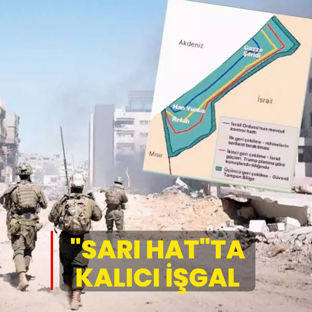 Sar hat'ta kalc igal