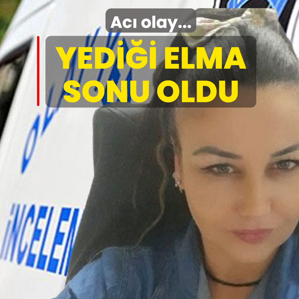 Ac� olay! Yedi�i elma sonu oldu