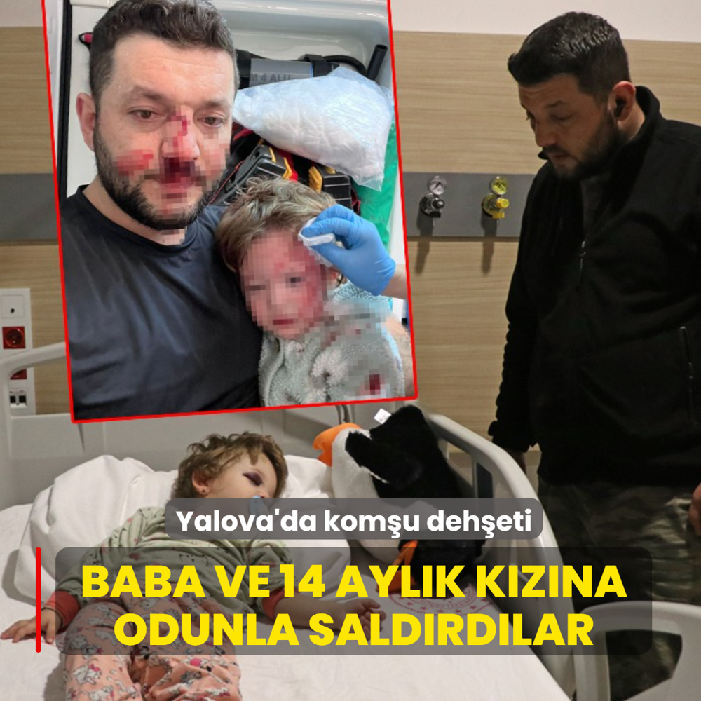 Yalova'da kom�u deh�eti! Baba ve 14 ayl�k k�z�na odunla sald�rd�lar