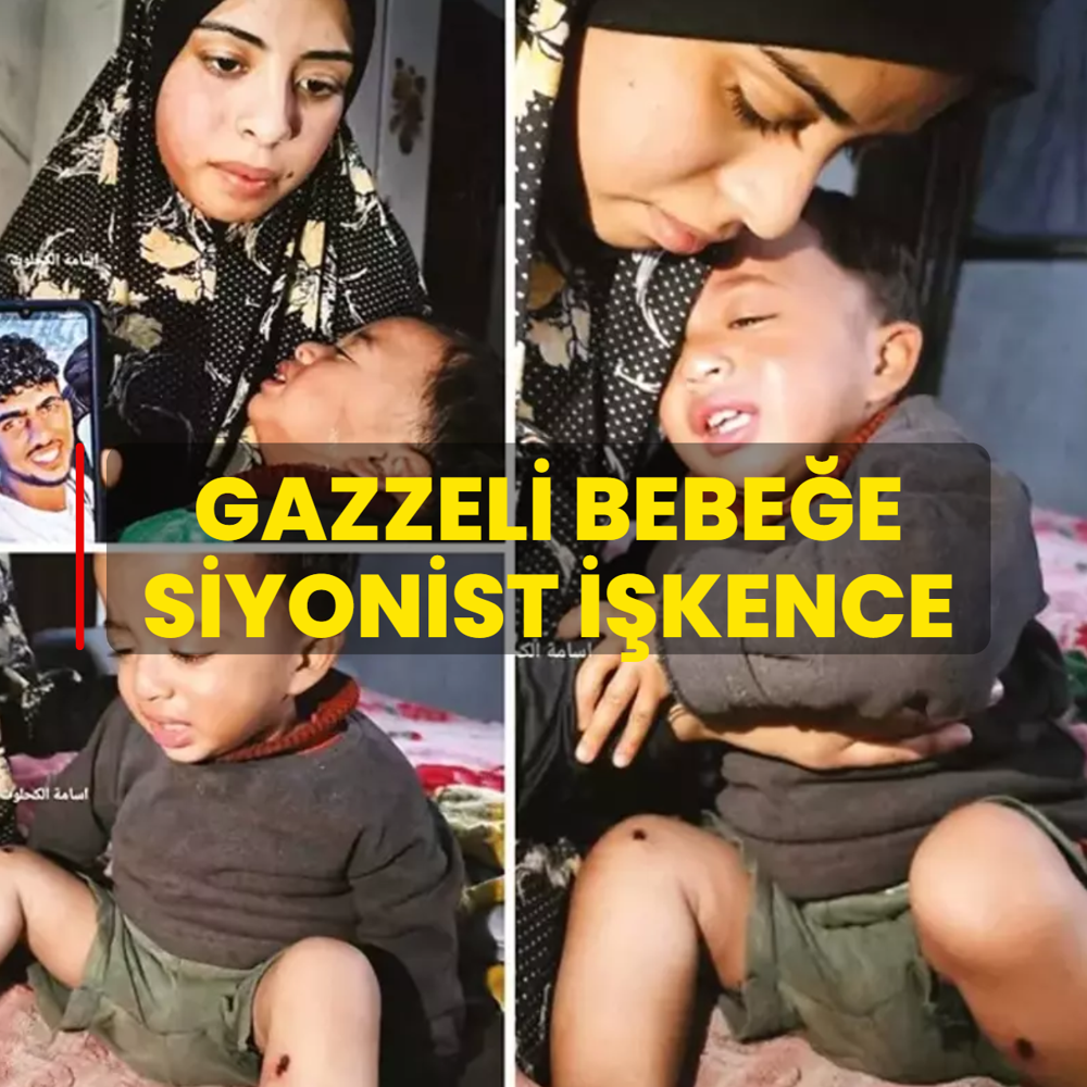 Gazzeli bebe�e Siyonist i�kence