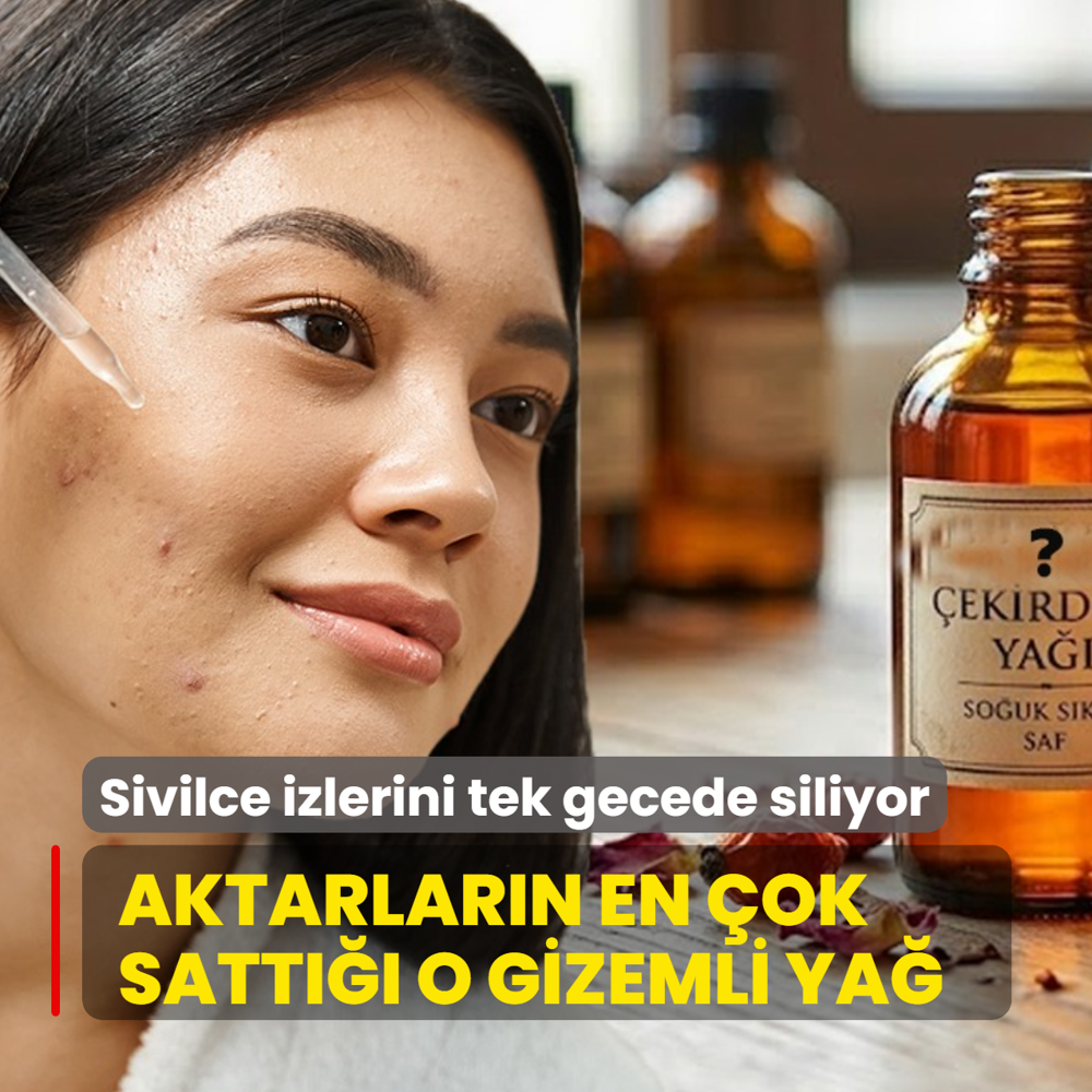 Sivilce izlerini tek gecede siliyor! Aktarlar�n en �ok satt��� o gizemli ya�