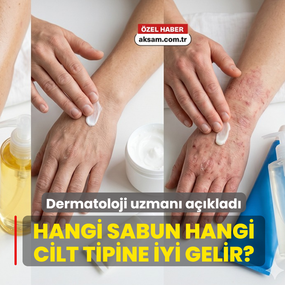 Hangi sabun hangi cilt tipine iyi gelir? Dermatoloji uzman� a��klad�