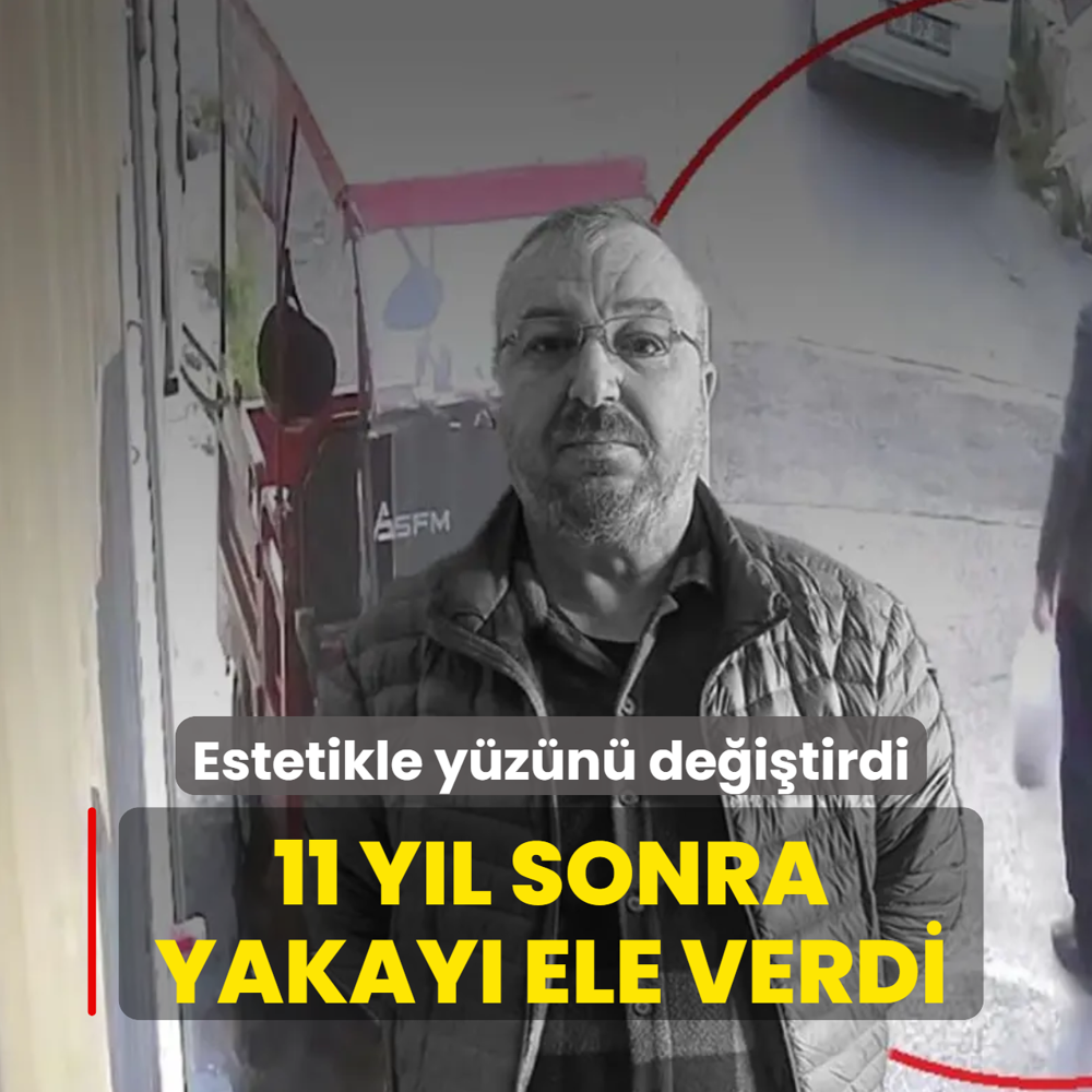 Estetikle y�z�n� de�i�tirdi! 11 y�l sonra yakay� ele verdi