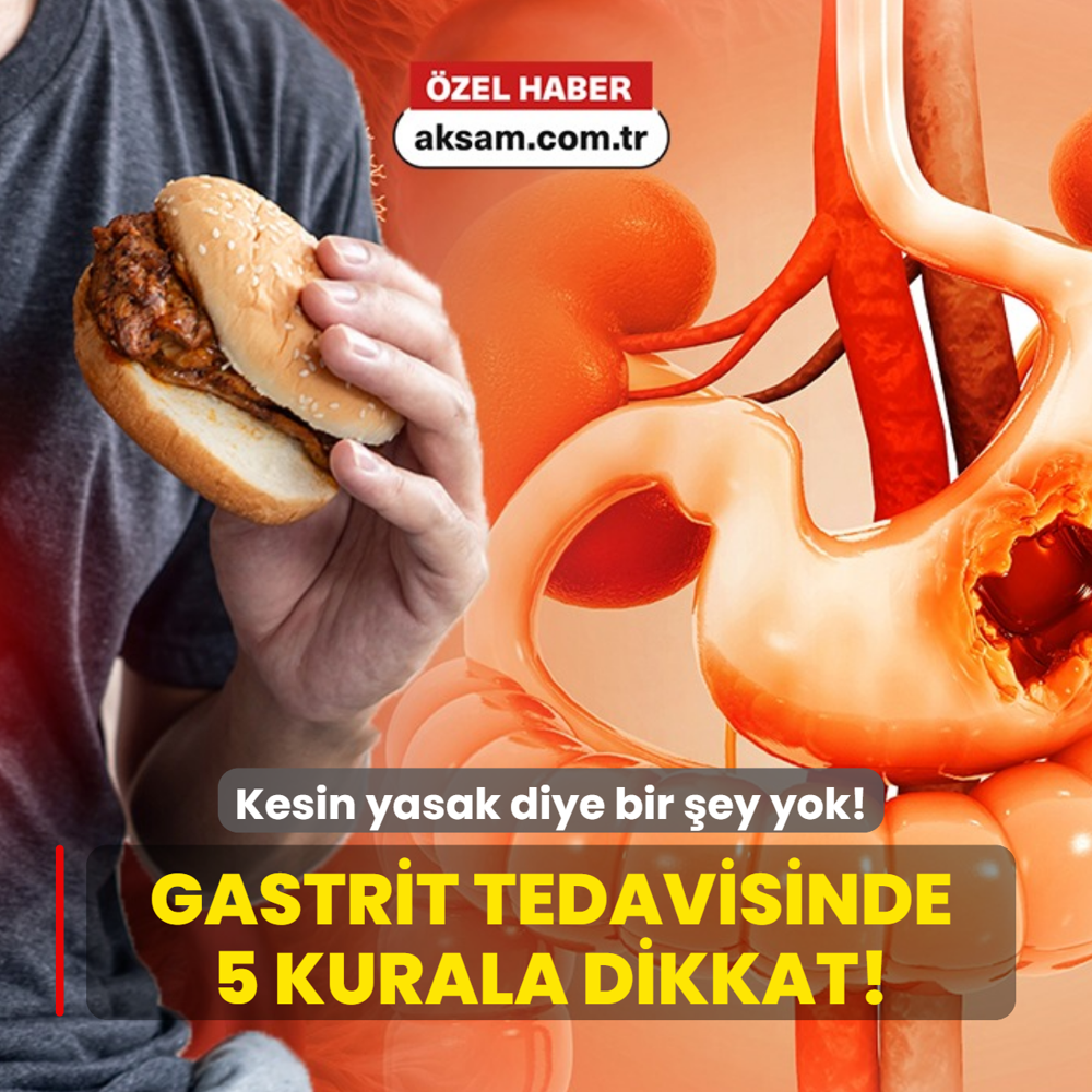 Gastrit tedavisinde ezber bozan a��klama: Kesin yasak diye bir �ey yok
